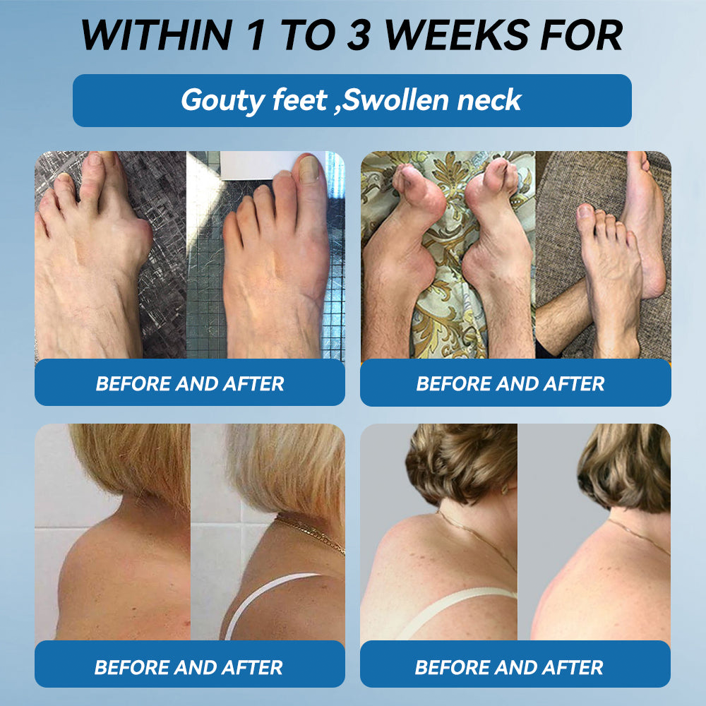 HONXI® BPC-157 Joint Healing Cream🦴Treats Arthritis, Neuropathy, Rheumatism, Sports Injuries & More 🌹