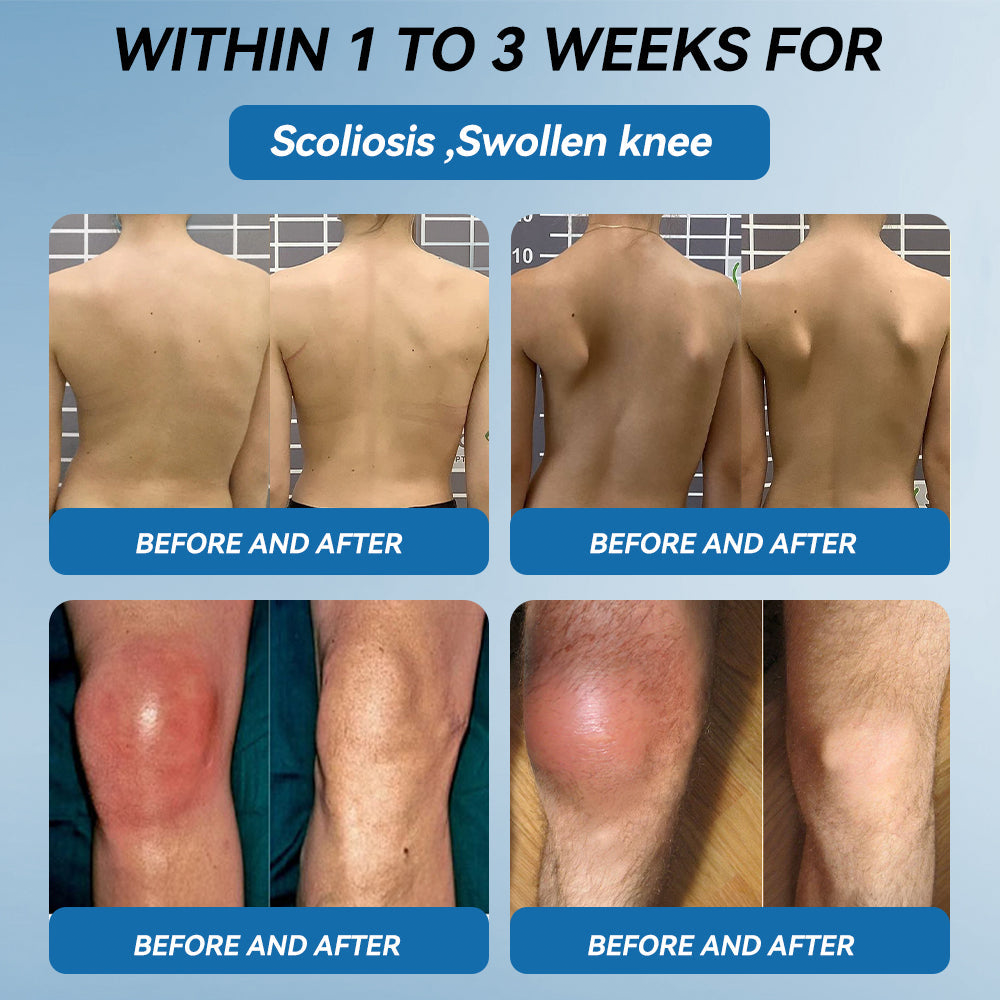 HONXI® BPC-157 Joint Healing Cream🦴Treats Arthritis, Neuropathy, Rheumatism, Sports Injuries & More 🌹