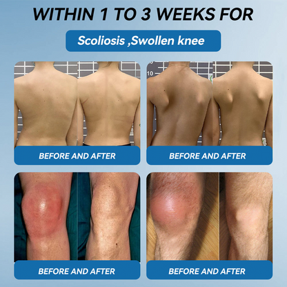 HONXI® BPC-157 Joint Healing Cream🦴Treats Arthritis, Neuropathy, Rheumatism, Sports Injuries & More 🌹