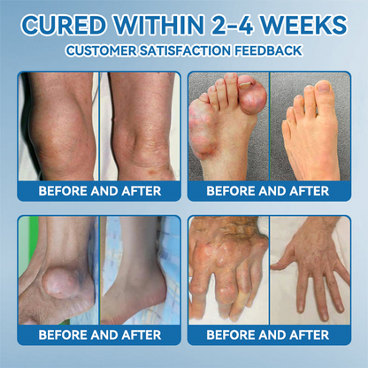 HONXI® BPC-157 Joint Healing Cream🦴Treats Arthritis, Neuropathy, Rheumatism, Sports Injuries & More 🌹