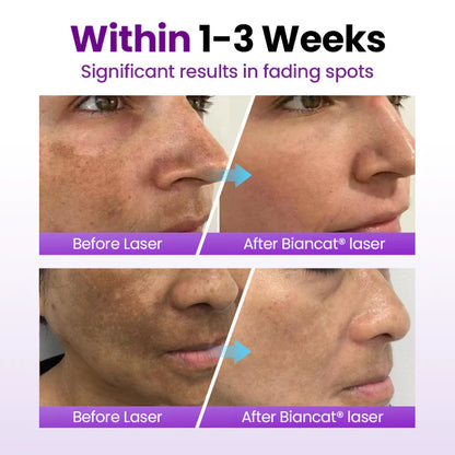 🔥SpotErase Probiotic Shield Serum