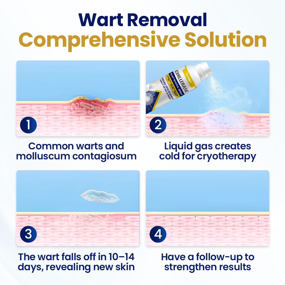 ❄️❄️❄️❄️Timilk® ChillErase Bump Renewal Spray