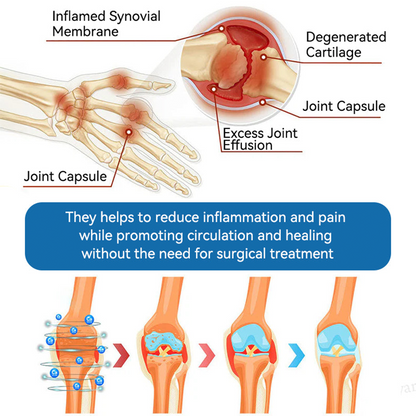 HONXI® BPC-157 Joint Healing Cream🦴Treats Arthritis, Neuropathy, Rheumatism, Sports Injuries & More 🌹