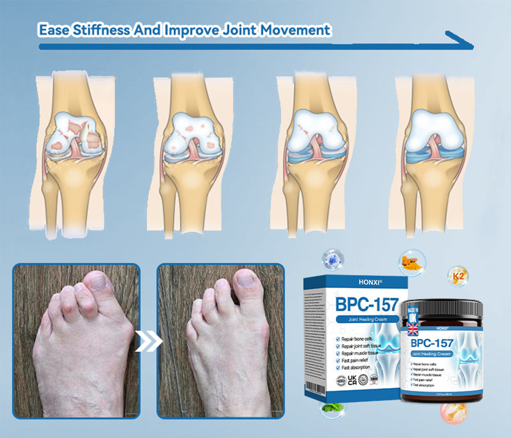 HONXI® BPC-157 Joint Healing Cream🦴Treats Arthritis, Neuropathy, Rheumatism, Sports Injuries & More 🌹