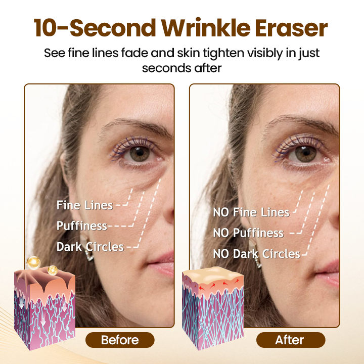 ✨Oveallgo® Liftora 10s Wrinkle Serum
