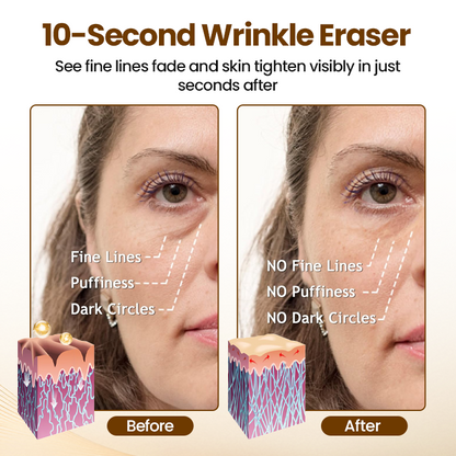 ✨Oveallgo® Liftora 10s Wrinkle Serum