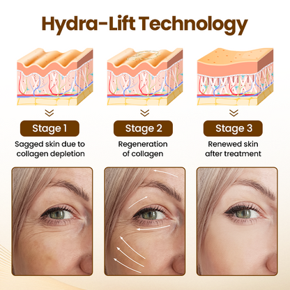 ✨Oveallgo® Liftora 10s Wrinkle Serum