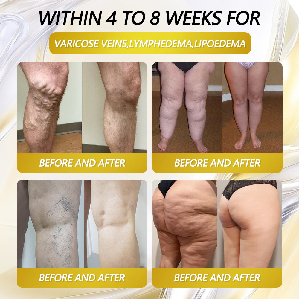 MHRA 🇬🇧 | Official UK 🇬🇧 Store — Croaie® Telportide Oral Solution, GIP and GLP-1 Dual-Action Weight Loss Solution, One Bottle Daily, Results in 7 Days🩹