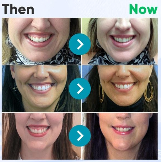 Rolimey® VioCore Bee Venom Dental Treatment Toothpaste