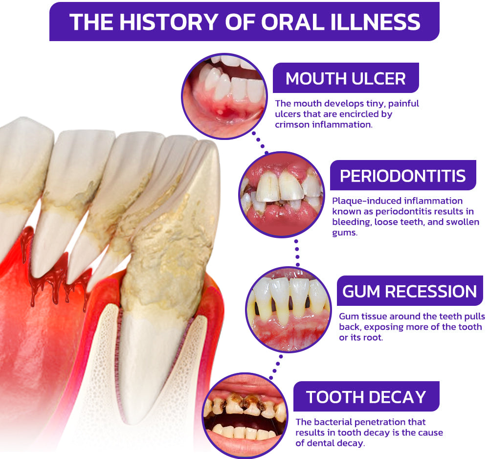 Rolimey® VioCore Bee Venom Dental Treatment Toothpaste